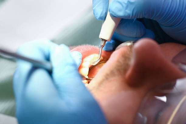 Best Emergency Pediatric Dental Care in San Carlos, TX